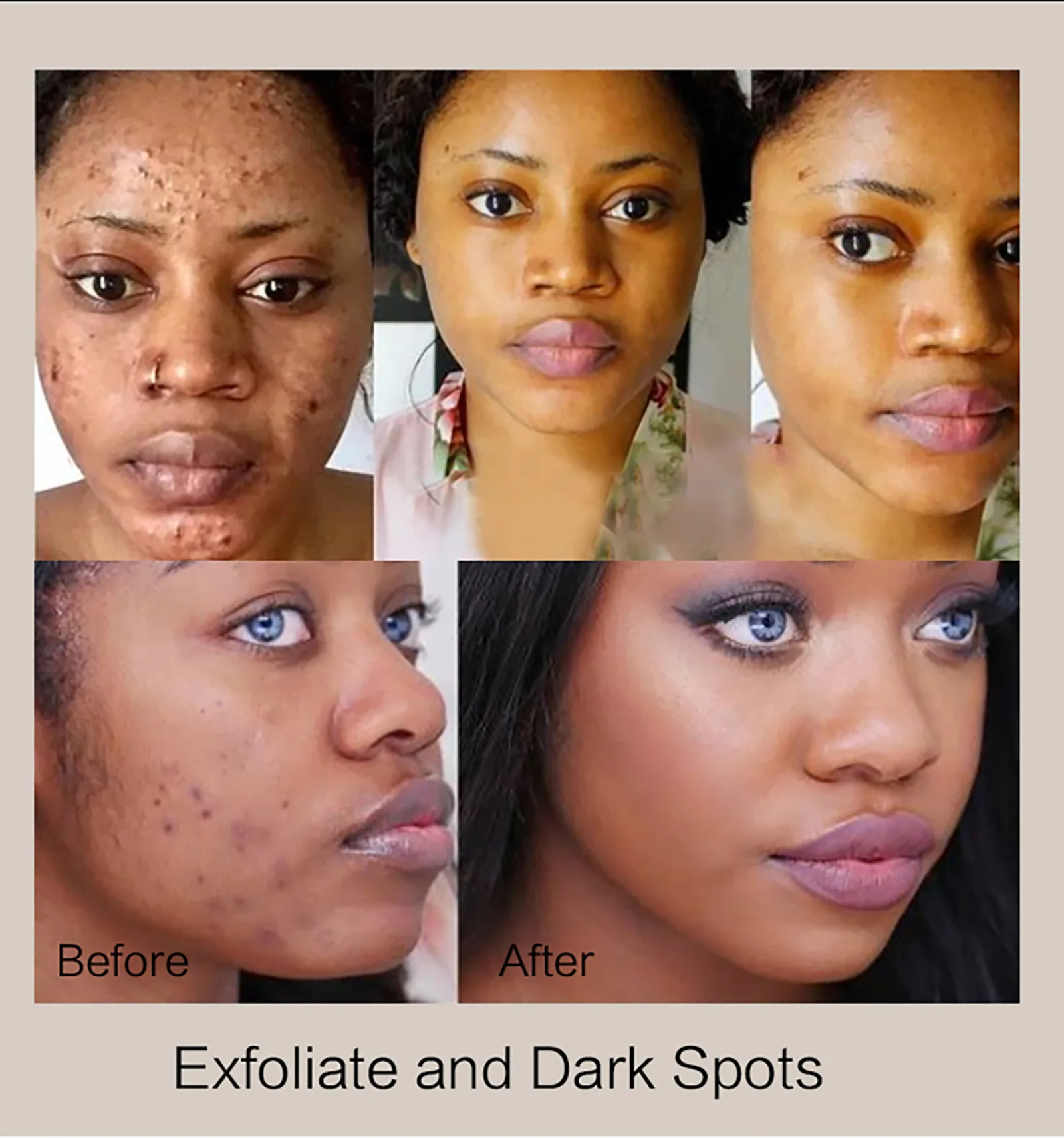 KYLIEFIT Coffee & Brazilian Nut Shea Sugar Scrub, Lightening, Whitening, Exfolilate, Nourishing, Cleaning Skin, for Face, Body KYLIEFIT Coffee & Brazilian Nut Shea Sugar Scrub, Lightening, Whitening, Exfolilate, Nourishing, Cleaning Skin, for Face, Body