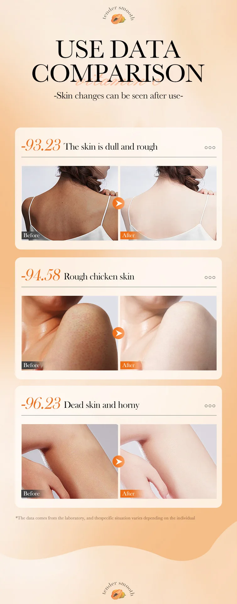 100g Papaya Vitamin C Exfoliating Scrub Cream, Hypoallergenic, Moisturizing, Exfoliation, Scented with Papaya, Deep Cleansing 100g Papaya Vitamin C Exfoliating Scrub Cream, Hypoallergenic, Moisturizing, Exfoliation, Scented with Papaya, Deep Cleansing