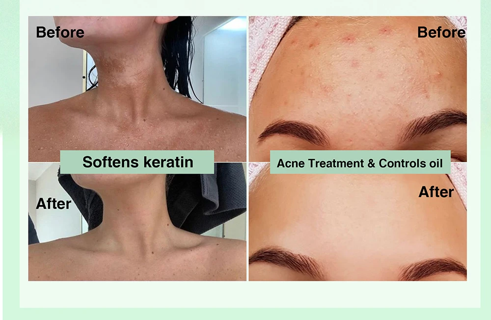 Natural Vanilla & Aloe Perfect Combination Scrub, With AHA, Reduce Spots, Acne, Clean Skin, Oil Control, For Face & Body Natural Vanilla & Aloe Perfect Combination Scrub, With AHA, Reduce Spots, Acne, Clean Skin, Oil Control, For Face & Body