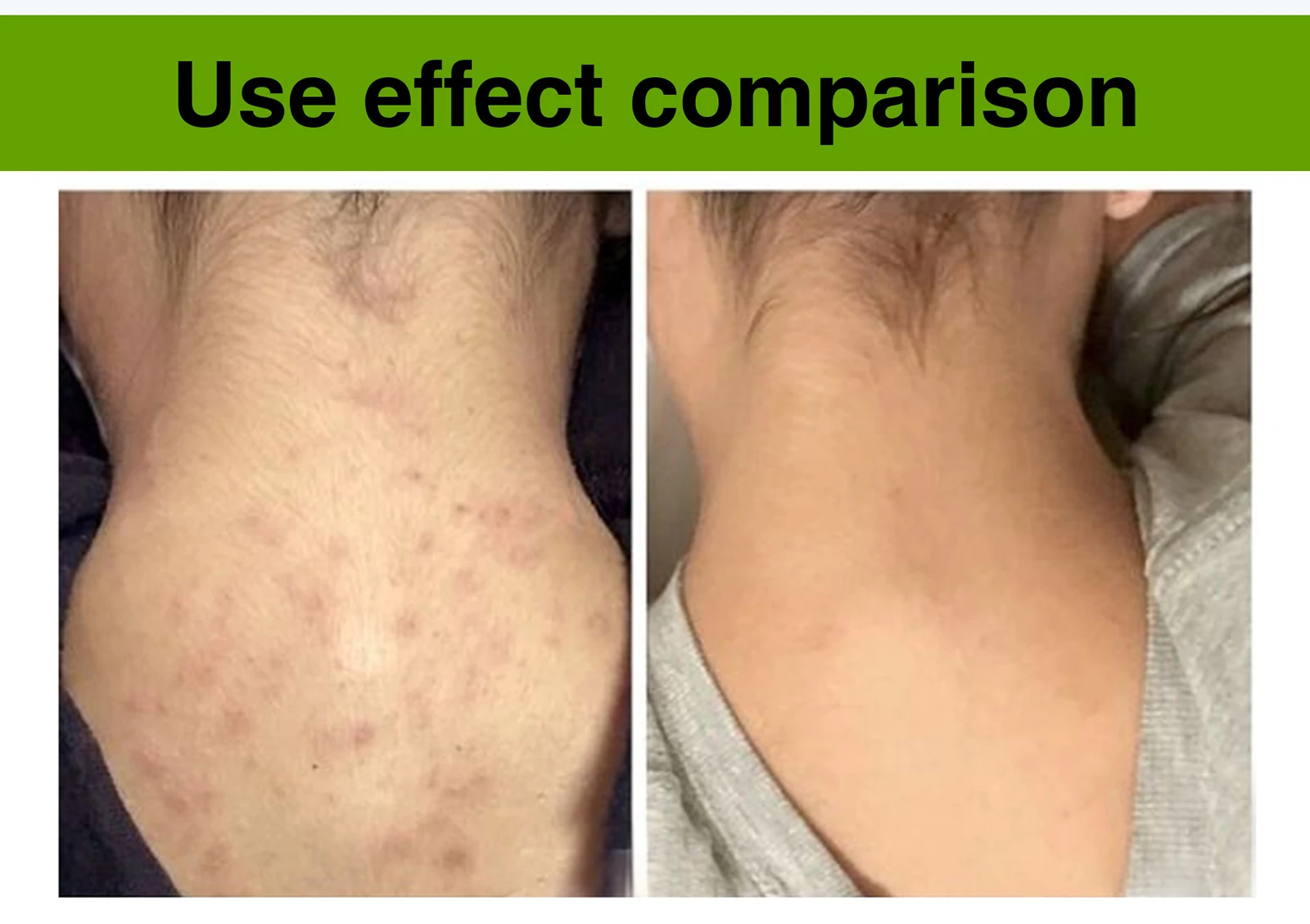 Natural Vanilla & Aloe Perfect Combination Scrub, With AHA, Reduce Spots, Acne, Clean Skin, Oil Control, For Face & Body Natural Vanilla & Aloe Perfect Combination Scrub, With AHA, Reduce Spots, Acne, Clean Skin, Oil Control, For Face & Body