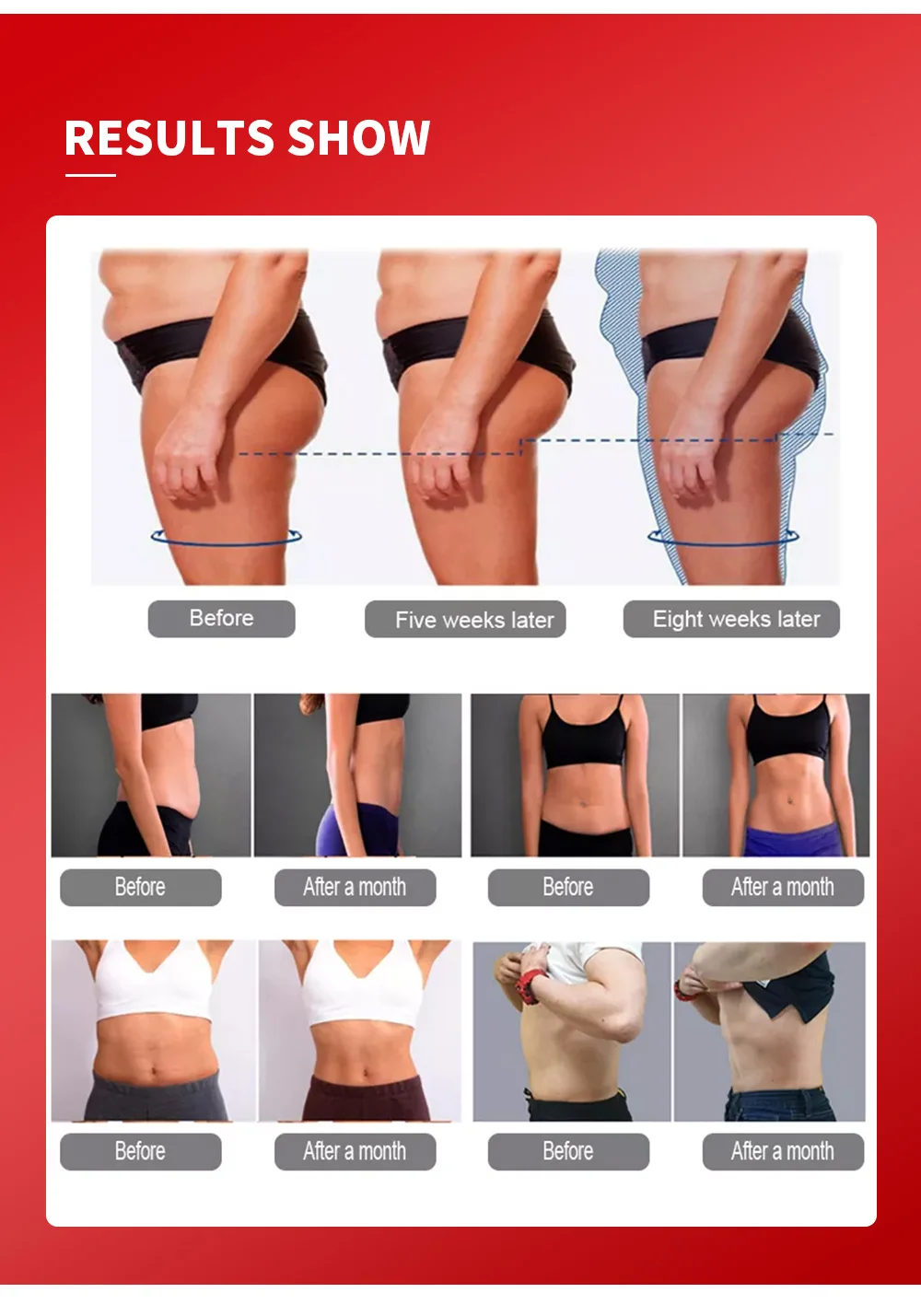 360° Inner Ball Roller Machine MYOslim For Body Contouring Cellulite Reduction Deep Tissue Massage and Circulation Improvement