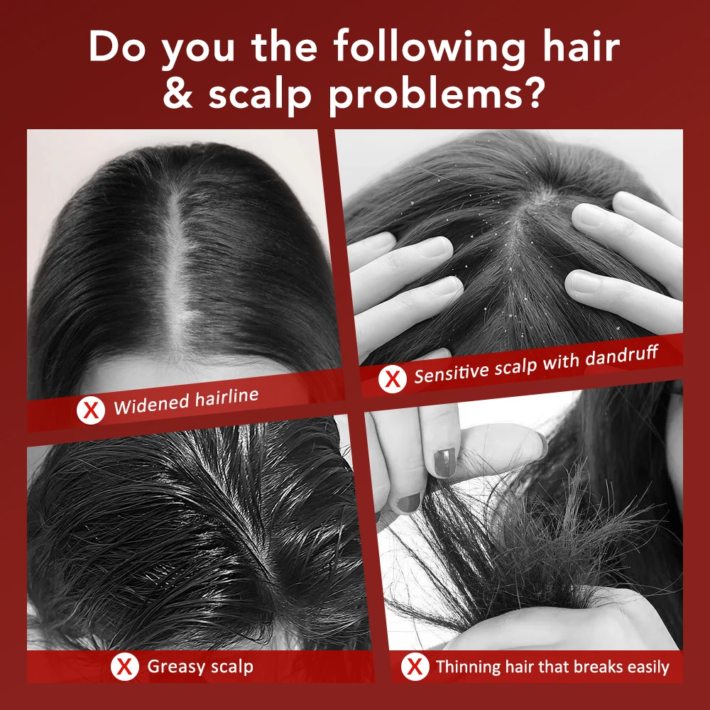 Massaggiatore elettrico per cuoio capelluto Pettine Terapia per la crescita dei capelli Micro-corrente Luce rossa e blu Trattamento anti-perdita di capelli Applicatore di olio