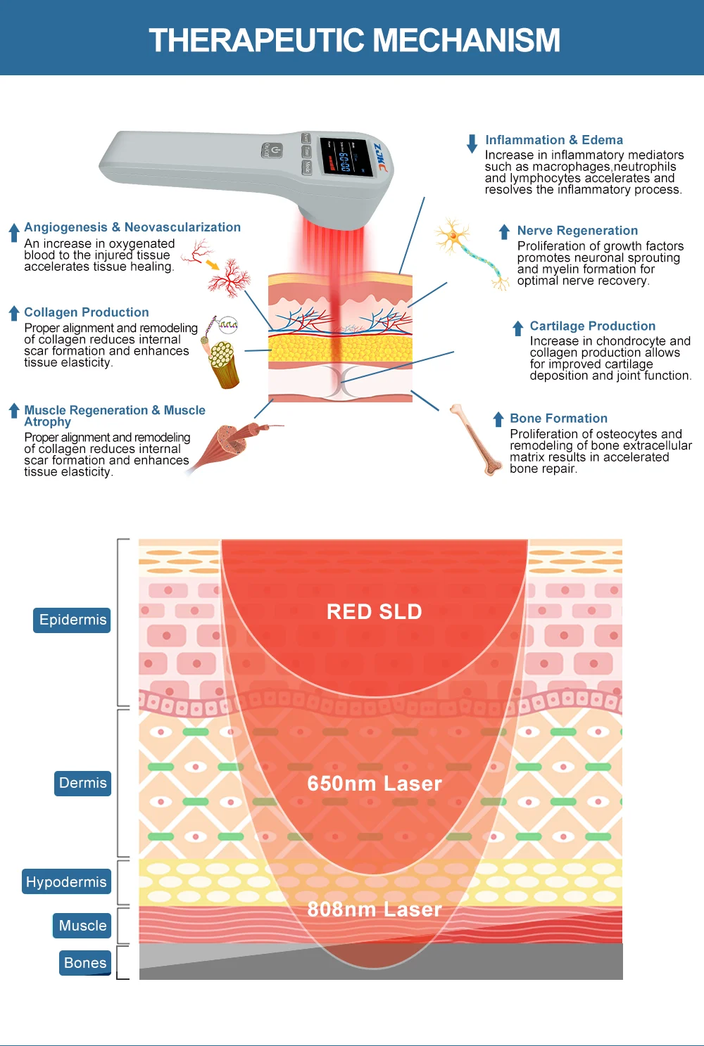 ZJKC Dispositivo professionale per terapia laser fredda per fisioterapia antidolore per lesioni alle ferite di cani e gatti da compagnia 650nm 808nm Palmare domestico
