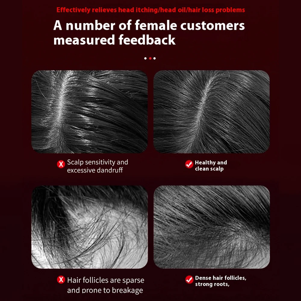 Pettine per massaggio elettrico Vibrazione Luce rossa Massaggio per la crescita dei capelli Spazzola per cuoio capelluto Applicatore di olio liquido anti-perdita di capelli