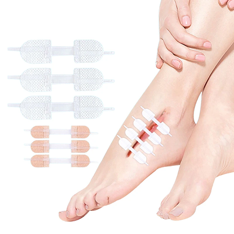 3 pezzi cerniera cravatta chiusura della ferita cerotto emostatico cerotto ferita sutura veloce cerotto cerniera cerotto all'aperto portatile cura della pelle