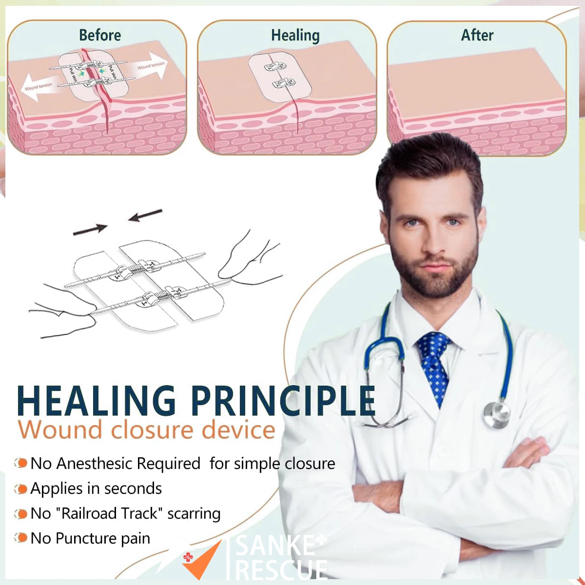 Cerotto con cerniera Dispositivo per la chiusura della ferita indolore Cerotti per medicazione per ferite senza sutura Cerotto per riduttore di sutura con cerniera