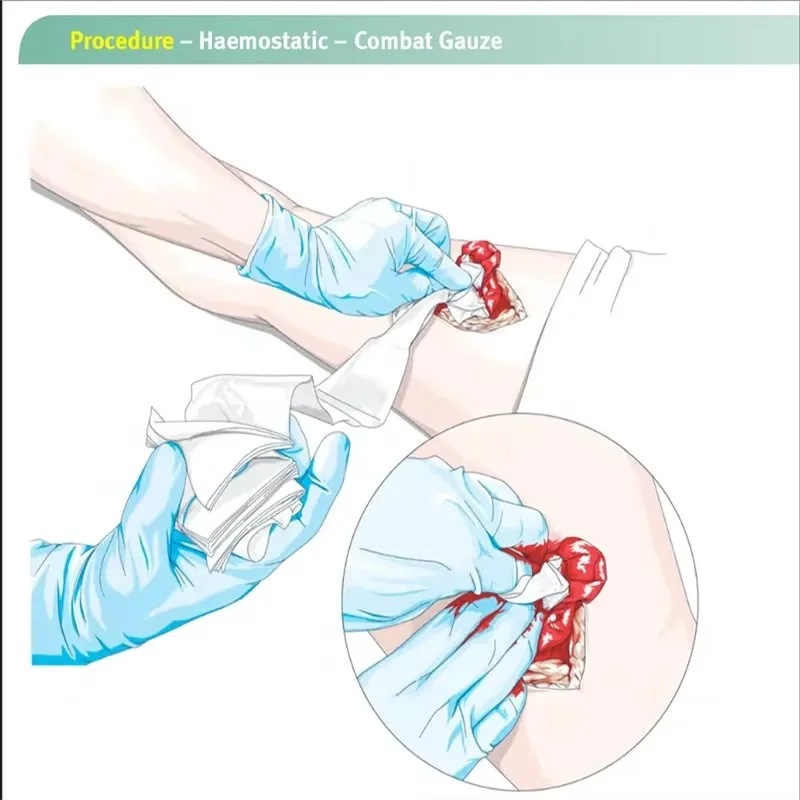 Garza emostatica di primo soccorso per esterni 3,7 metri di terza generazione Nuova garza emostatica caolino Garza per coagulazione emostatica rapida Garza emostatica di primo soccorso per esterni 3,7 metri di terza generazione Nuova garza emostatica caolino Garza per coagulazione emostatica rapida