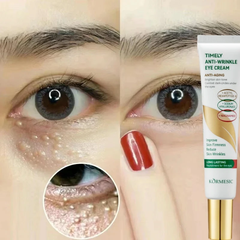 Crema per gli occhi anti-cerchio scuro Crema per la rimozione dei granuli di grasso Anti-rughe Lifting Idratante Rassodante Anti-gonfiore Cura della pelle coreana