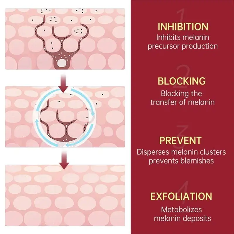 Potente crema sbiancante per la rimozione delle macchie Illumina la pelle Elimina rapidamente la pigmentazione della melanina Melasma Macchie scure Cura della pelle coreana
