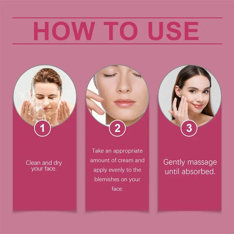 Potente crema sbiancante per la rimozione delle macchie Illumina la pelle Elimina rapidamente la pigmentazione della melanina Melasma Macchie scure Cura della pelle coreana