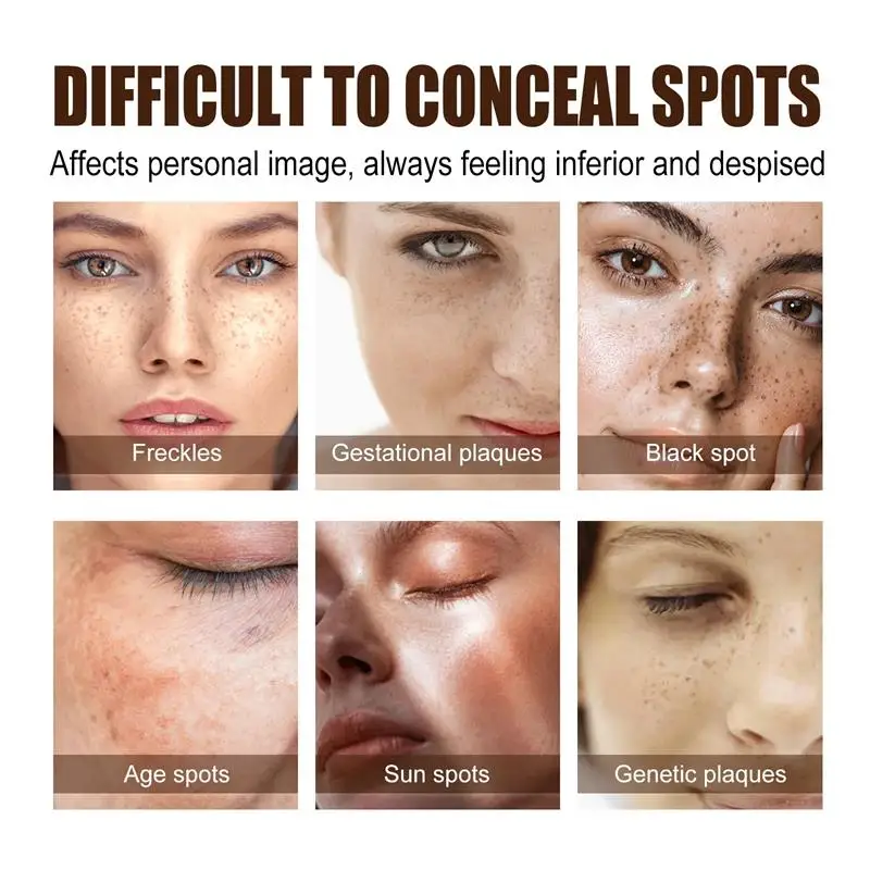 Potente crema sbiancante per la rimozione delle macchie Illumina la pelle Elimina rapidamente la pigmentazione della melanina Melasma Macchie scure Cura della pelle coreana